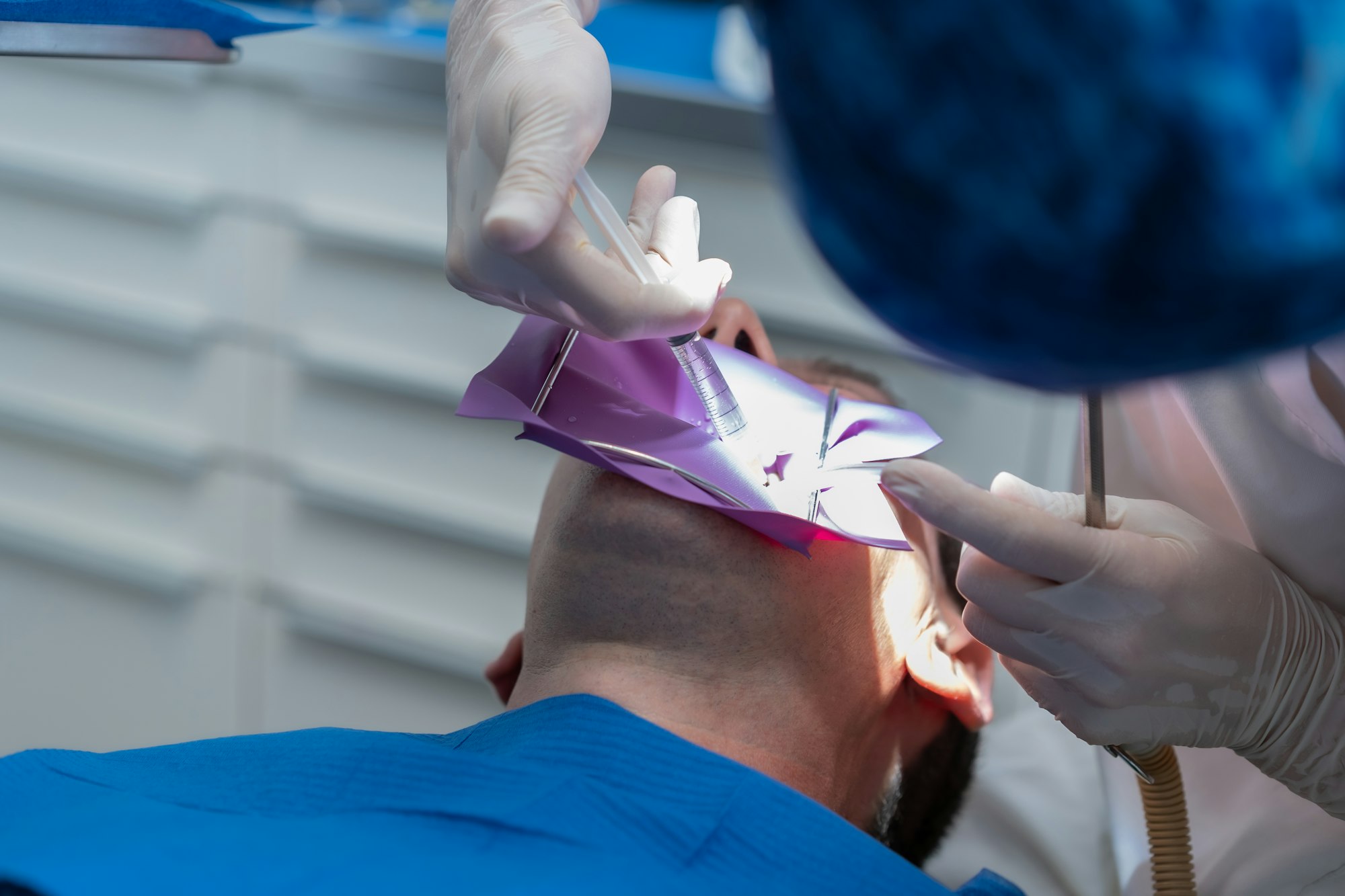 Dental clinic, detail a doctor performing an endodontics to a patient in full operation